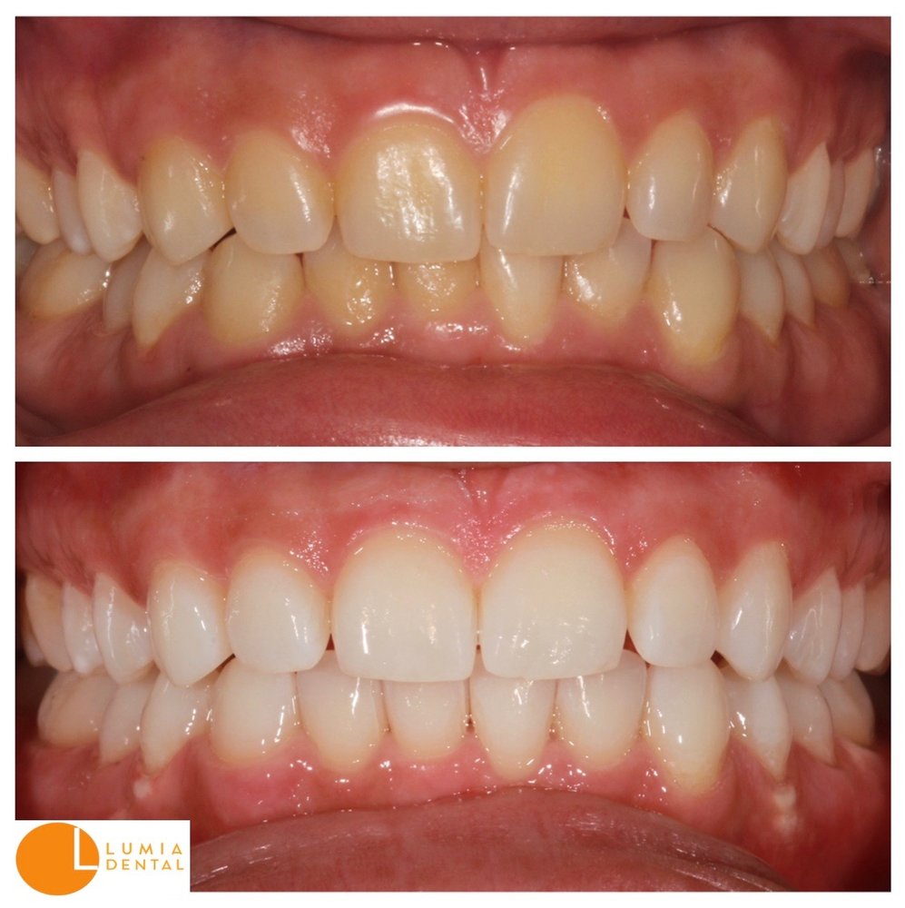 Lumia Dental New York